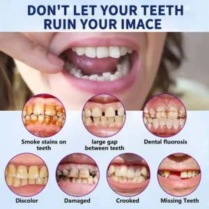 NESLEMY™ Advanced Customized Full Denture Set
