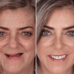 GripSure™ Denture Adhesive | Secure Fit & Maximum Comfort in Seconds!