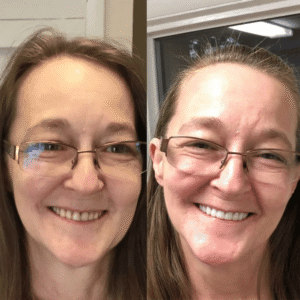 GripSure™ Denture Adhesive | Secure Fit & Maximum Comfort in Seconds!