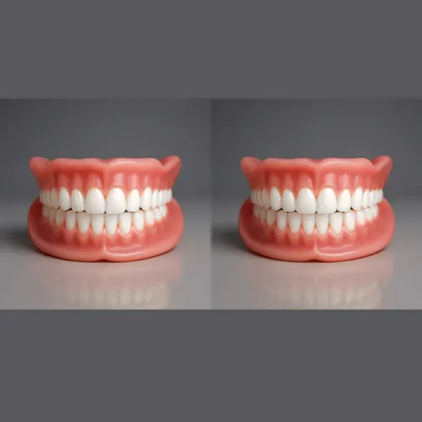 NESLEMY™ Custom-Fit Functional Dentures