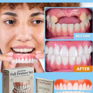 Hidone® Advanced Customized Full Denture Set image Hidone® Advanced Customized Full Denture