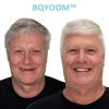 BQYOOM™ Dentures | Invisible Comfort, Natural Grip image BQYOOM™ Dentures | Invisible Comfort, Natural Grip