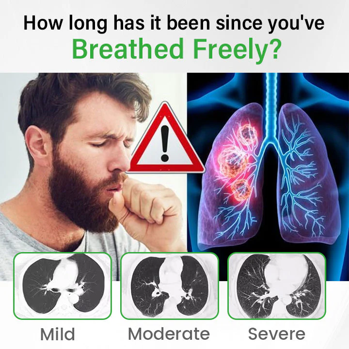 Cheemex® Lung health Detox Inhaler image Cheemex® Lung health Detox Inhaler