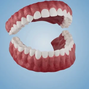 Cvreoz® Adsorptive denture