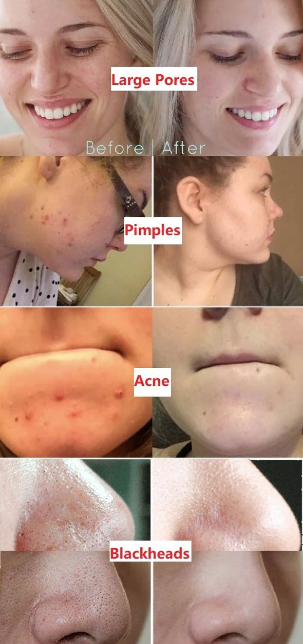 Diystar™ Green Tea Deep Cleanse Mask Stick image Diystar™ Green Tea Deep Cleanse Mask Stick