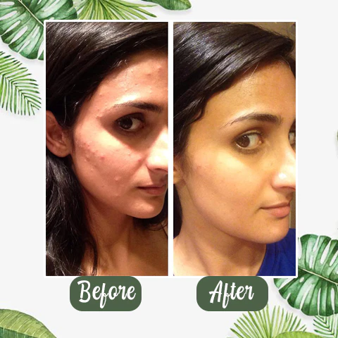 Diystar™ Green Tea Deep Cleanse Mask Stick image Diystar™ Green Tea Deep Cleanse Mask Stick