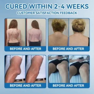 LOVILDS™ BPC-157 Joint Healing Cream image LOVILDS™ BPC-157 Joint Healing Cream