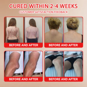 Turonu® Horse Balm Gentle · Extra Strength image Turonu® Horse Balm Gentle · Extra Strength