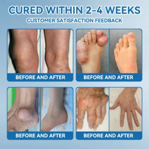 Zvoevo® BPC-157 Joint Healing Cream