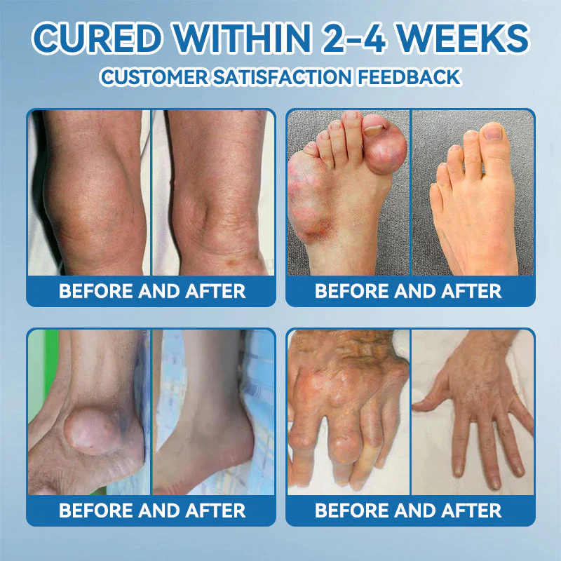 LOVILDS™ BPC-157 Joint Healing Cream image LOVILDS™ BPC-157 Joint Healing Cream