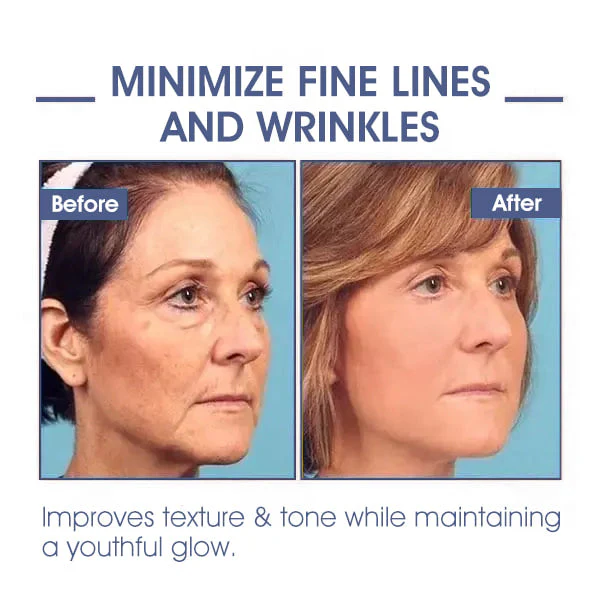 LOVILDS® Ultimate Firming & Rejuvenating Cream image LOVILDS® Ultimate Firming & Rejuvenating Cream - Image 12