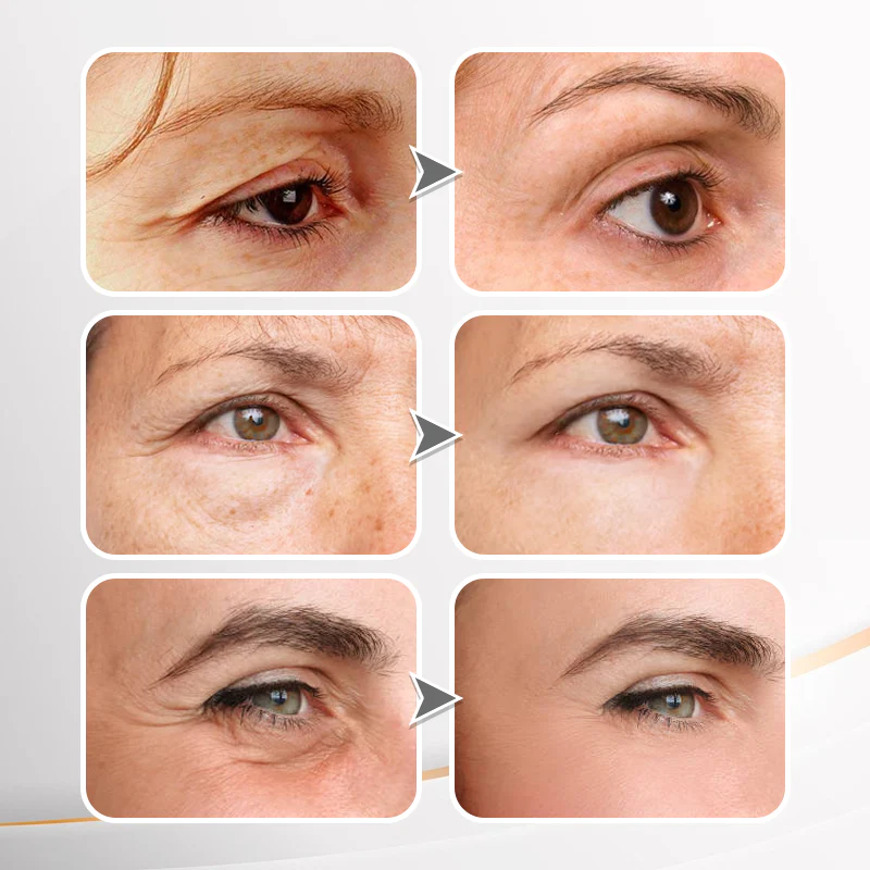 NESLEMY Eye Cream image NESLEMY Eye Cream