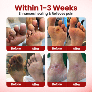 VitaGluco Diabetic Care Cream image VitaGluco Diabetic Care Cream