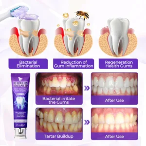 Oveallgo® BeeRenew Advanced Gum Healing Toothpaste image Oveallgo® BeeRenew Advanced Gum Healing Toothpaste