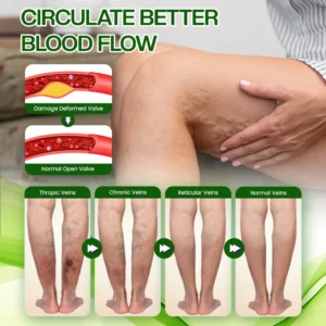 Timilk® SwellRelief Horse Chestnut Edema Cream