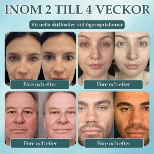 Spzv®Opti Fusion Nano Eye Drops image Spzv®Opti Fusion Nano Eye Drops