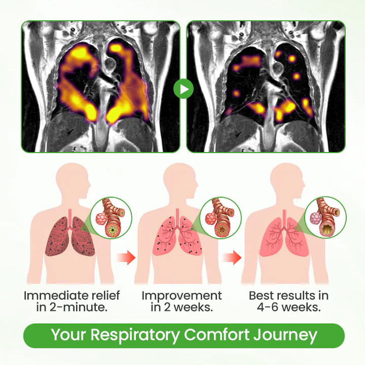 Cvreoz® HerbaAir Mullein Lung Purifier image Cvreoz® HerbaAir Mullein Lung Purifier