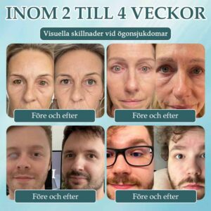 Spzv®Opti Fusion Nano Eye Drops image Spzv®Opti Fusion Nano Eye Drops