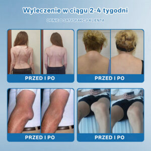 Foulme® BPC-157 Joint Regenerating Cream