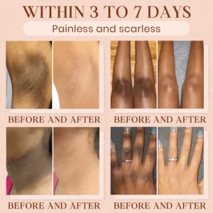 Cvreoz® Purifying Exfoliating Gel image Cvreoz® Purifying Exfoliating Gel