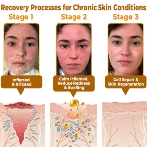 BBOJI™Bee venom Comprehensive Cream