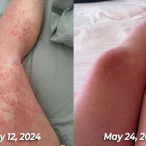 BBOJI™Bee venom Comprehensive Cream