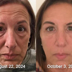 BBOJI™Bee venom Comprehensive Cream