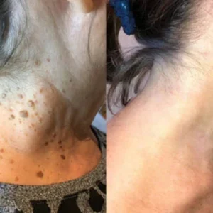 BBOJI™Bee venom Comprehensive Cream