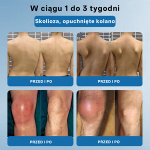 Foulme® BPC-157 Joint Regenerating Cream