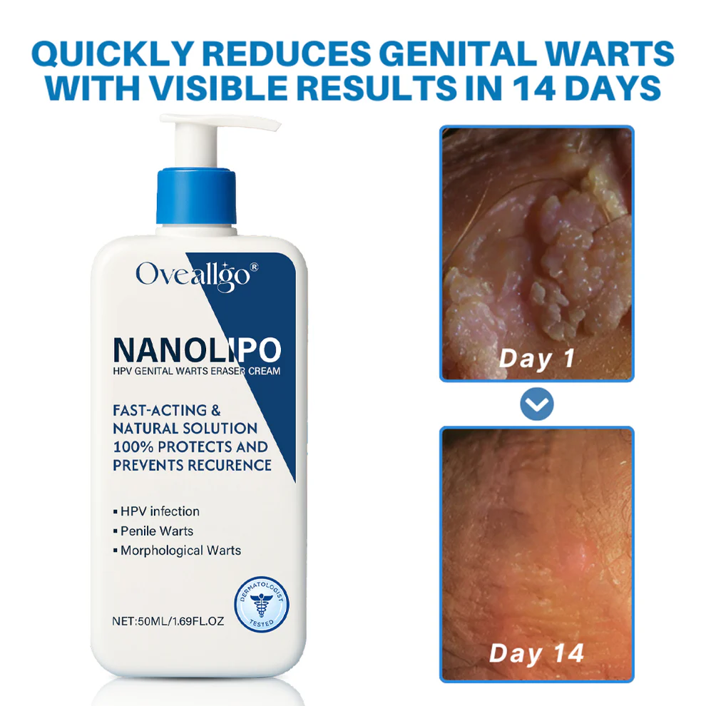 Oveallgo® NanoLipo HPV Genital Warts Eraser Cream ProX image Oveallgo® NanoLipo HPV Genital Warts Eraser Cream ProX