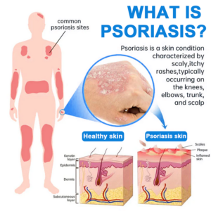 LAOZIK™ Magnesium Herbal Spray