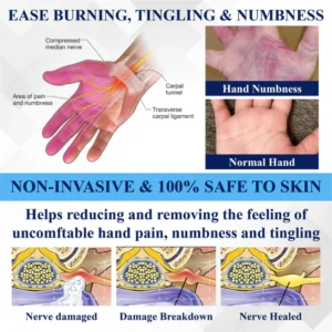 NovaRX® NerveRelief LC Medical Treatment Cream