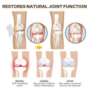 NovaRX® Bee Venom Joint Therapy Botanical Patch