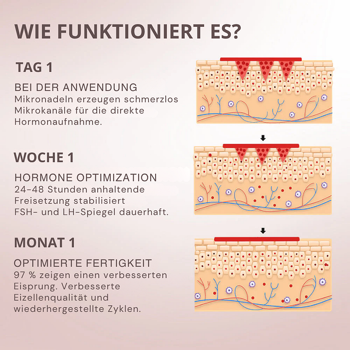 Oveallgo® FertiliPatch Mikronadeln Fruchtbarkeit Verbesserung System image Oveallgo® FertiliPatch Mikronadeln Fruchtbarkeit Verbesserung System