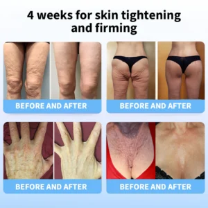 LOVILDS® Ultimate Firming & Rejuvenating Cream image LOVILDS® Ultimate Firming & Rejuvenating Cream