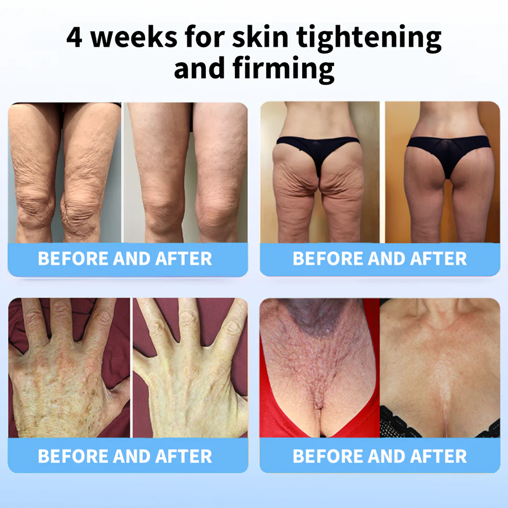 LOVILDS® Ultimate Firming & Rejuvenating Cream image LOVILDS® Ultimate Firming & Rejuvenating Cream