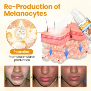 Timilk® VitiGone Rapid Spray