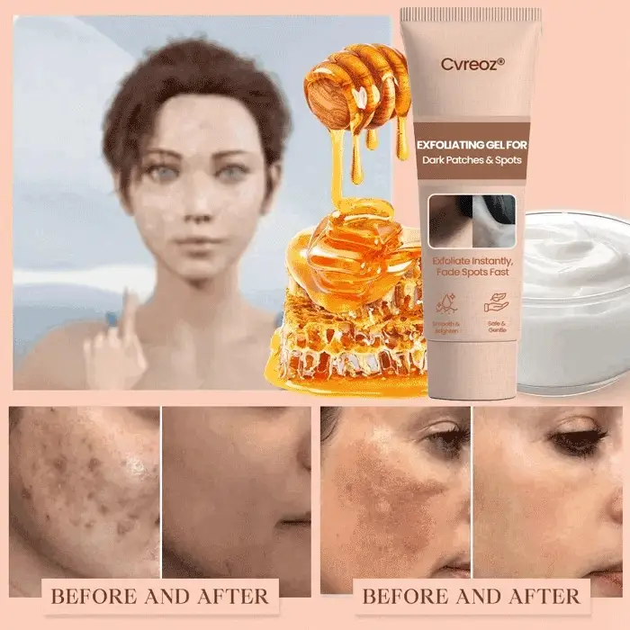 Cvreoz® Purifying Exfoliating Gel image Cvreoz® Purifying Exfoliating Gel