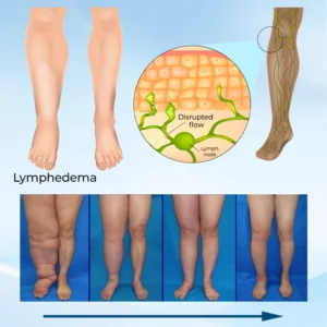 Timilk® LymphoEase Magnesium PCA Roll-On Relief Cream