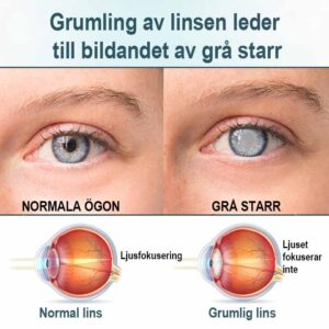 Spzv®Opti Fusion Nano Eye Drops image Spzv®Opti Fusion Nano Eye Drops