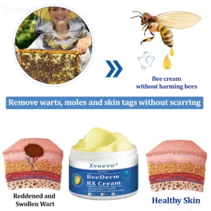 Zvoevo® BeeDerm RX Cream, Painless, Targeted Treatment image Zvoevo® BeeDerm RX Cream, Painless, Targeted Treatment