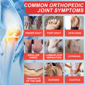 Turonu® Horse Balm Gentle · Extra Strength image Turonu® Horse Balm Gentle · Extra Strength