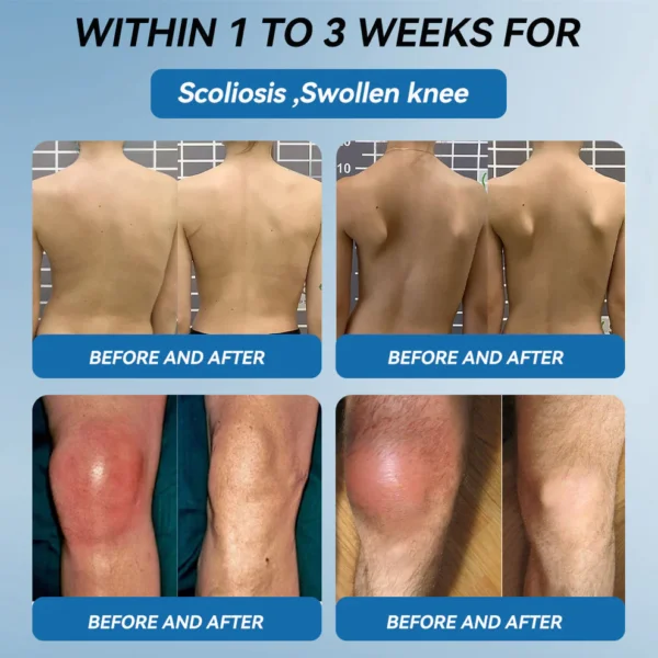 Zvoevo® BPC-157 Joint Healing Cream