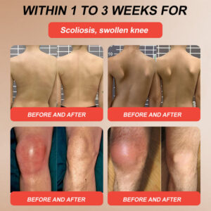 Turonu® Horse Balm Gentle · Extra Strength image Turonu® Horse Balm Gentle · Extra Strength