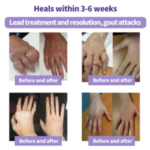 Lovilds™ Turmeric & Emu Oil Arthritis Soothing Pain Relief Massage Gel