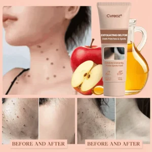 Cvreoz® Purifying Exfoliating Gel image Cvreoz® Purifying Exfoliating Gel