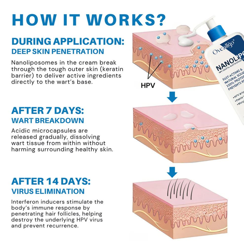 Oveallgo® NanoLipo HPV Genital Warts Eraser Cream ProX image Oveallgo® NanoLipo HPV Genital Warts Eraser Cream ProX