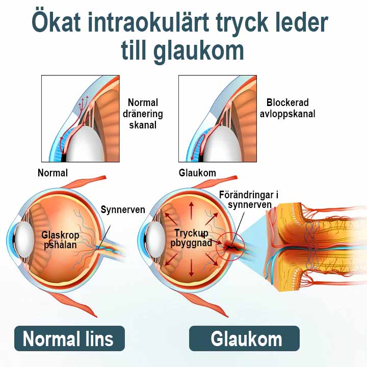 Spzv®Opti Fusion Nano Eye Drops image Spzv®Opti Fusion Nano Eye Drops