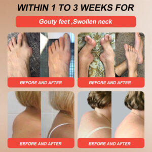 Turonu® Horse Balm Gentle · Extra Strength image Turonu® Horse Balm Gentle · Extra Strength