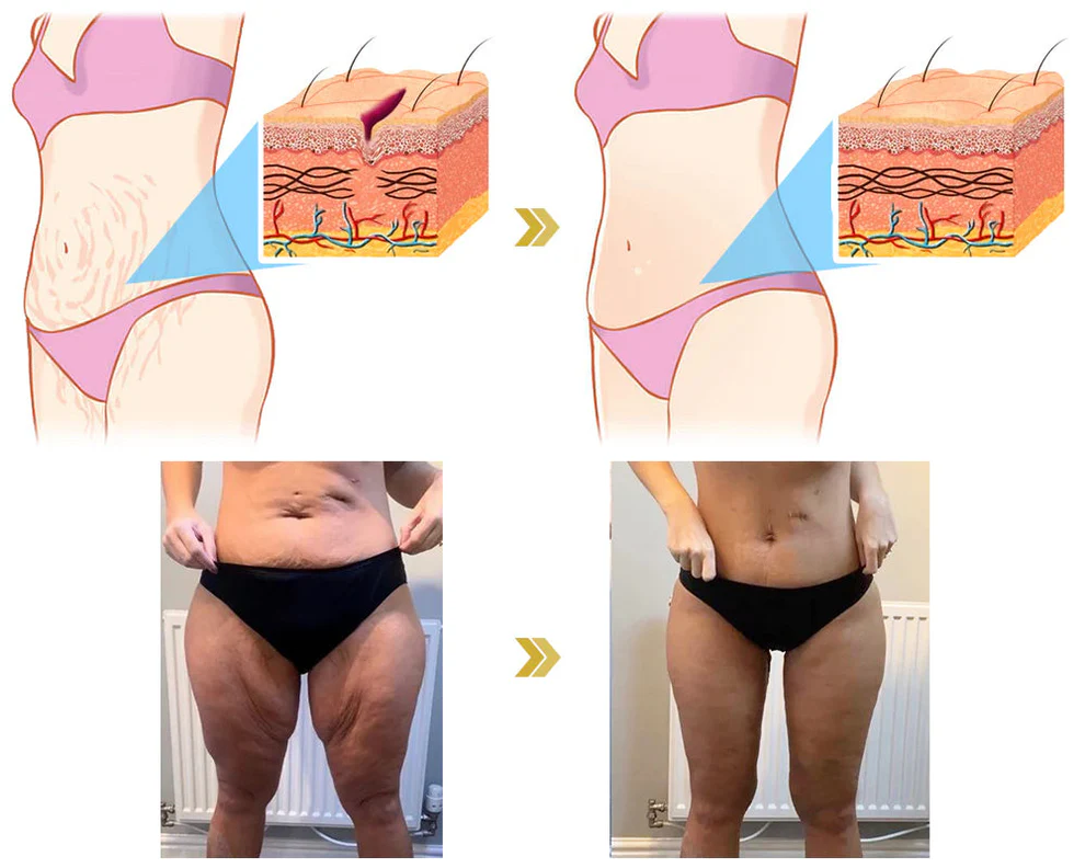 LOVILDS® Ultimate Firming & Rejuvenating Cream image LOVILDS® Ultimate Firming & Rejuvenating Cream